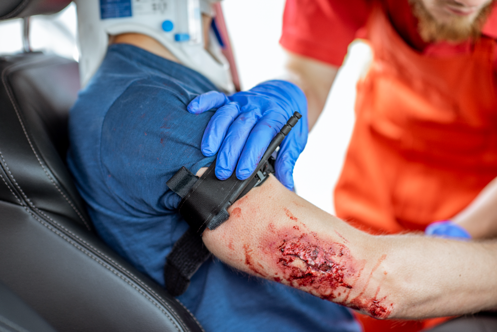 catastrophic injury claims in Mississippi