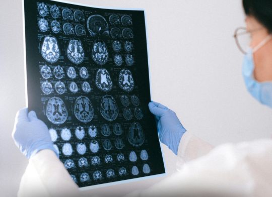 Can You Survive Severe Brain Damage?